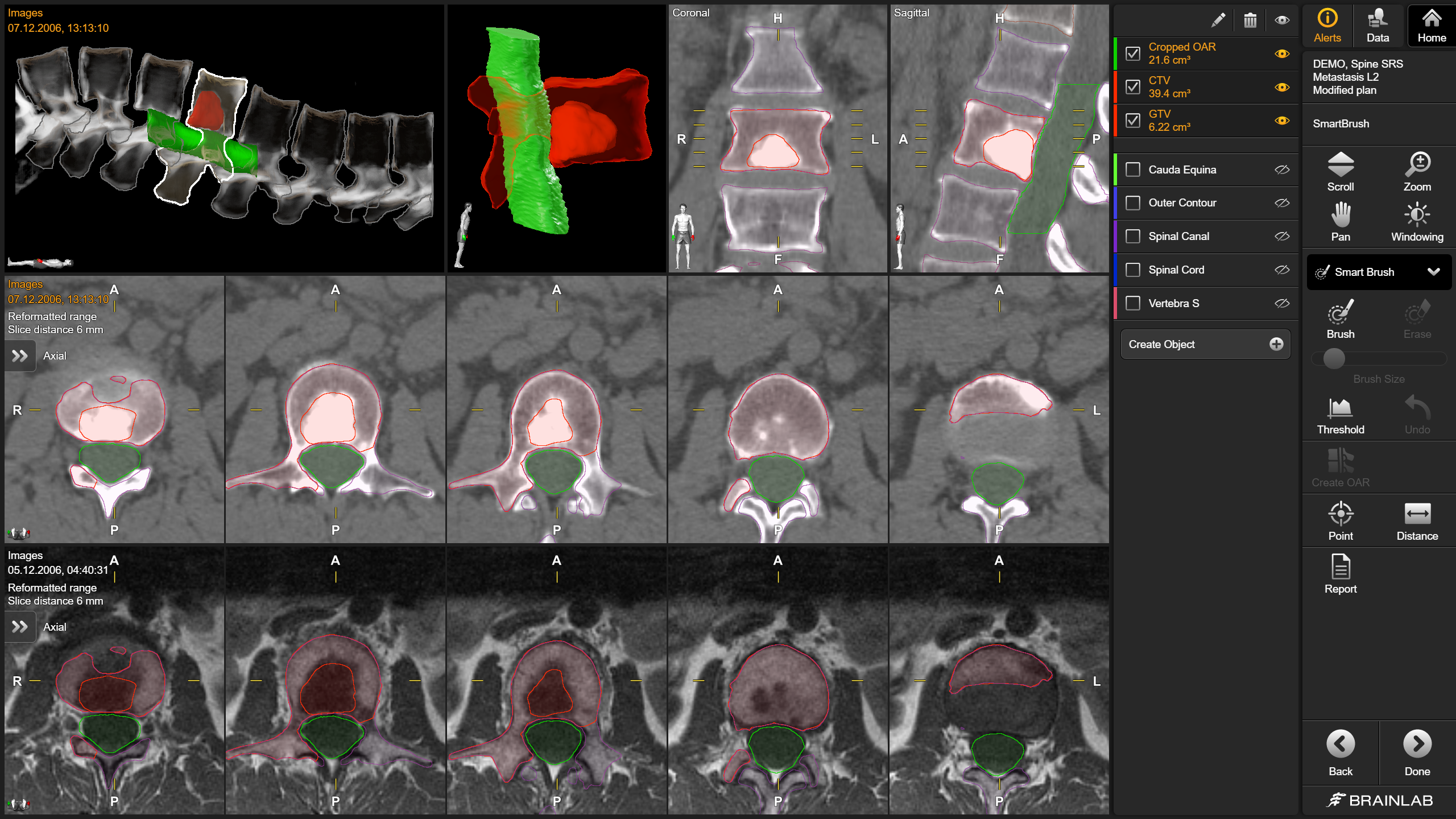 マスターテクニックRelevant Surgical Exposures 第2版 Tech_Ref_Pharmaceutical